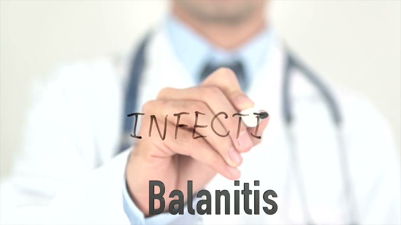 Balanitis and balanoposthitis Holistic Andrology